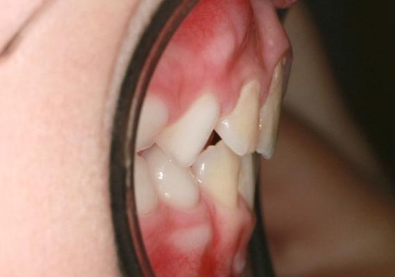 здоровые зубы в 7 лет в профиль